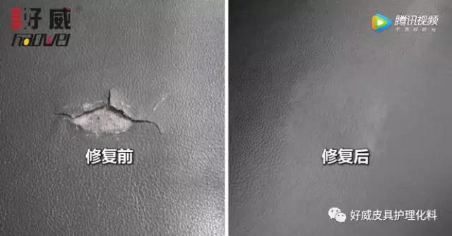 真皮修復(fù)