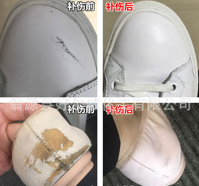真皮修復(fù)