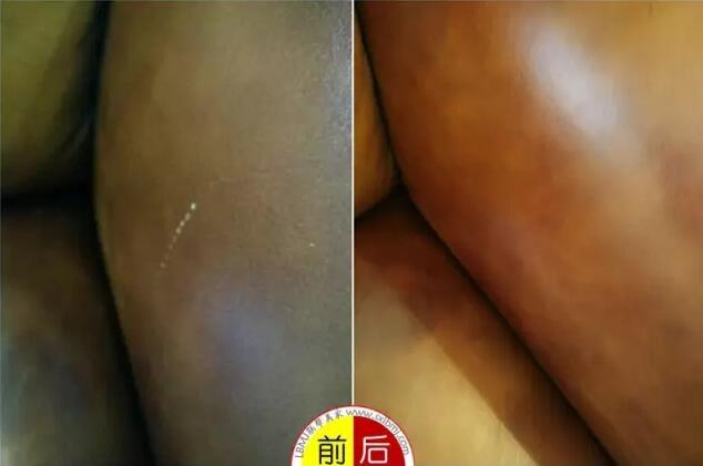 真皮沙發(fā)修補方法丨真皮沙發(fā)裂紋如何修復